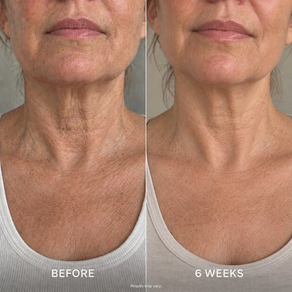 Firm & Smooth Neck Cream with Dual Massage Rollers